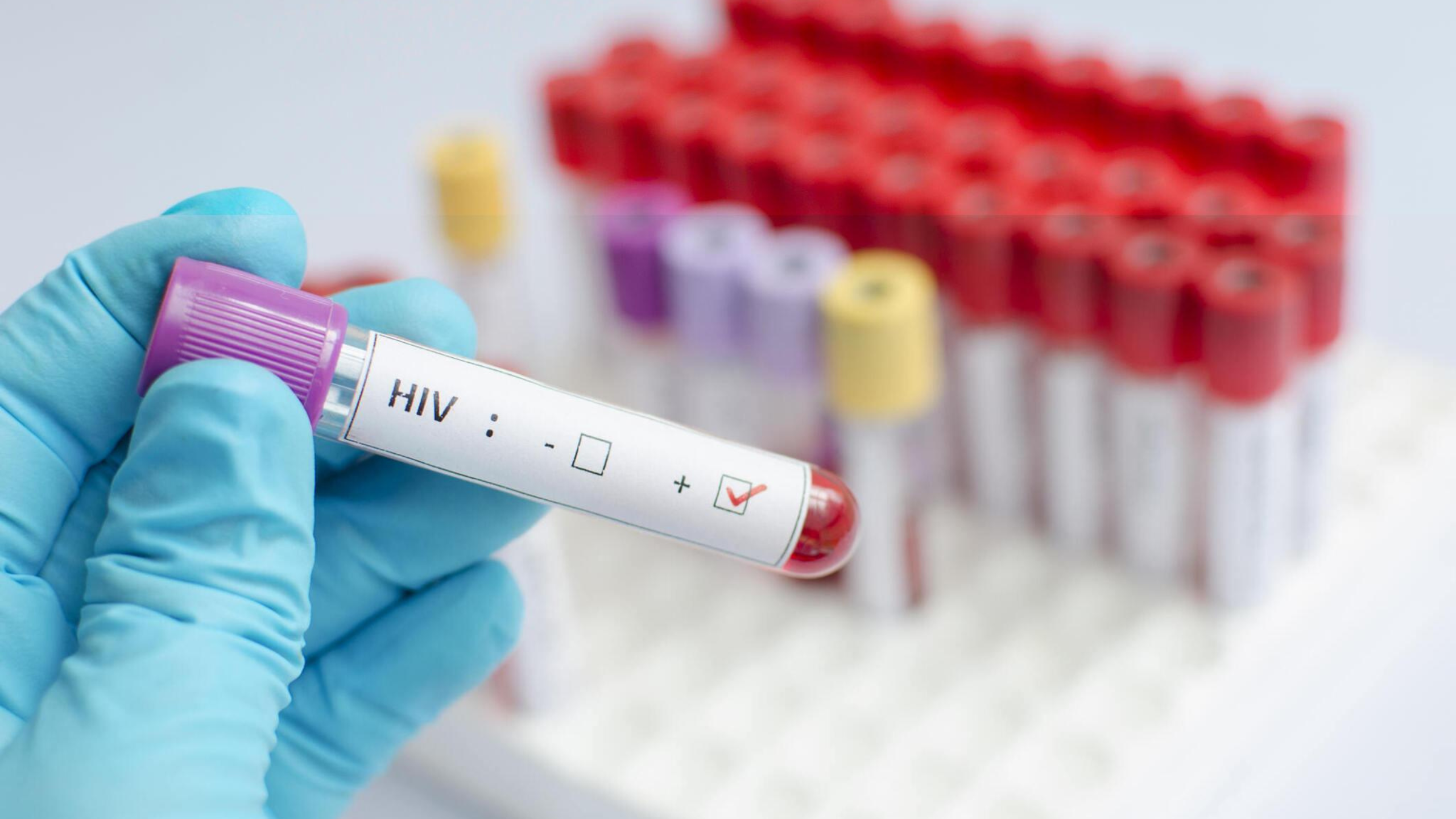 HIV Testing