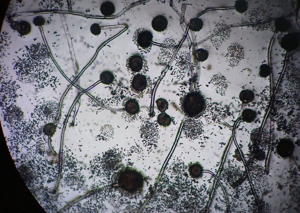 Microscopic image of bacteria during lab test for STDs.