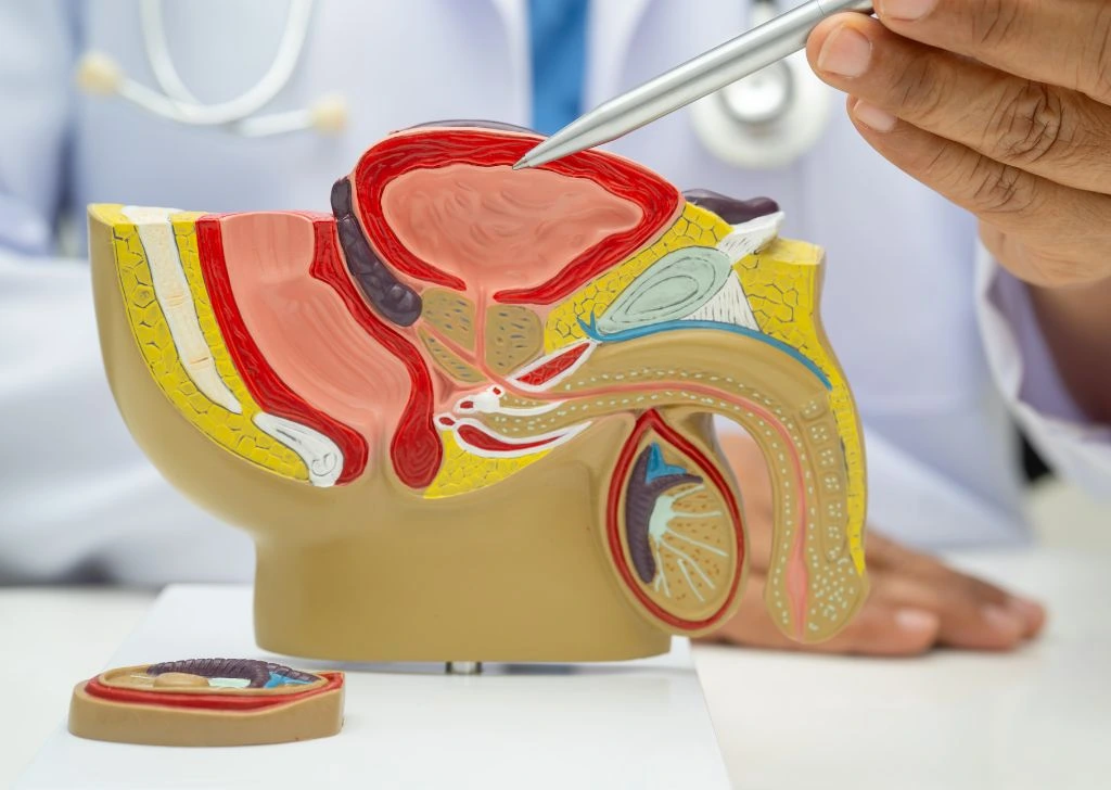 A doctor using a male reproductive system model to explain how Peyronie's disease causes curved penises.