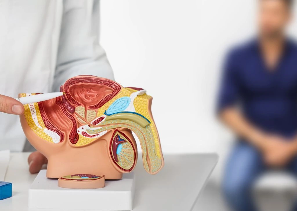 A doctor using a male reproductive system model to explain the effects of a curved penis caused by Peyronie's.