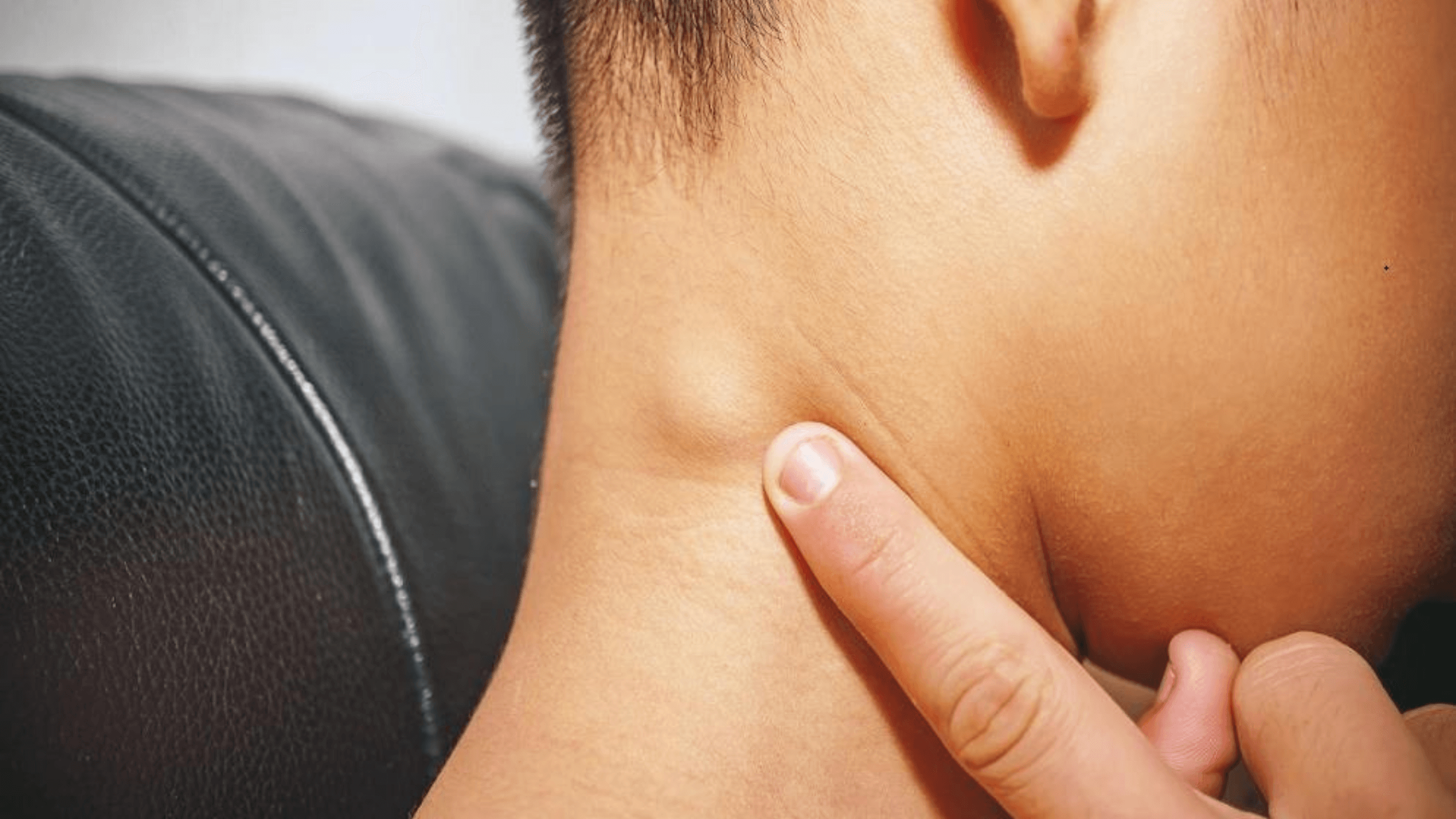 Swollen Lymph Nodes