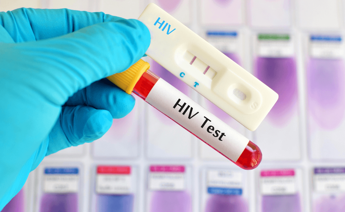 Rapid HIV Test