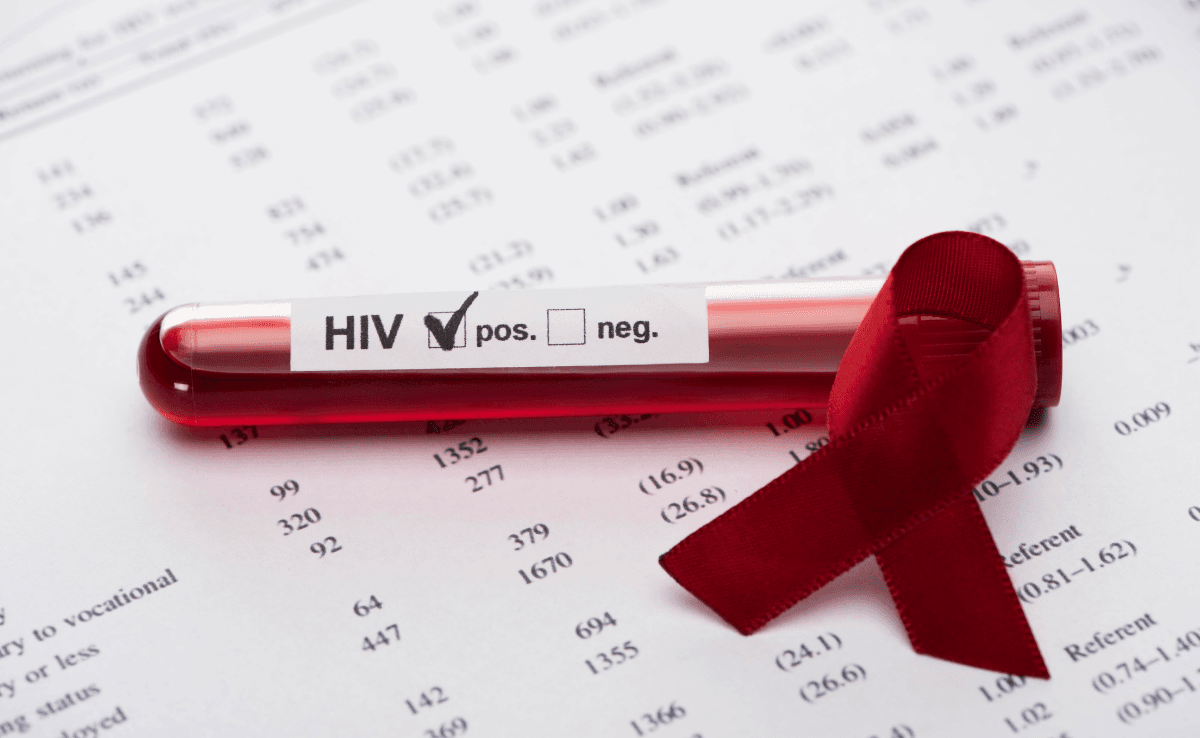 positive hiv blood sample test on paper result