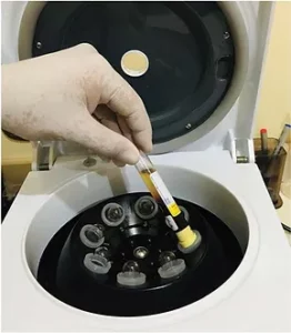 PRP centrifudge