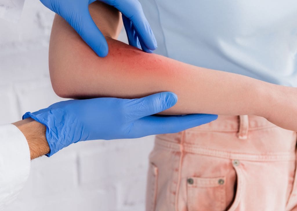 Tanda & Rawatan Gonorrhea (penyakit gonore) di Malaysia | Klinik He Medical