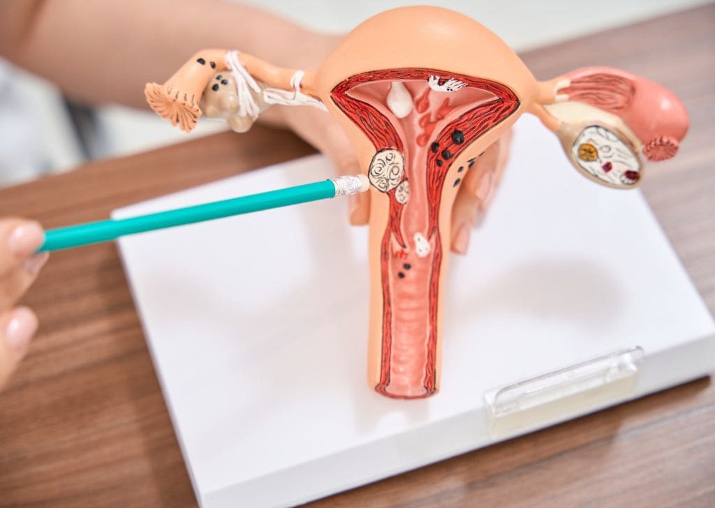 Tanda & Rawatan Gonorrhea (penyakit gonore) di Malaysia | Klinik He Medical