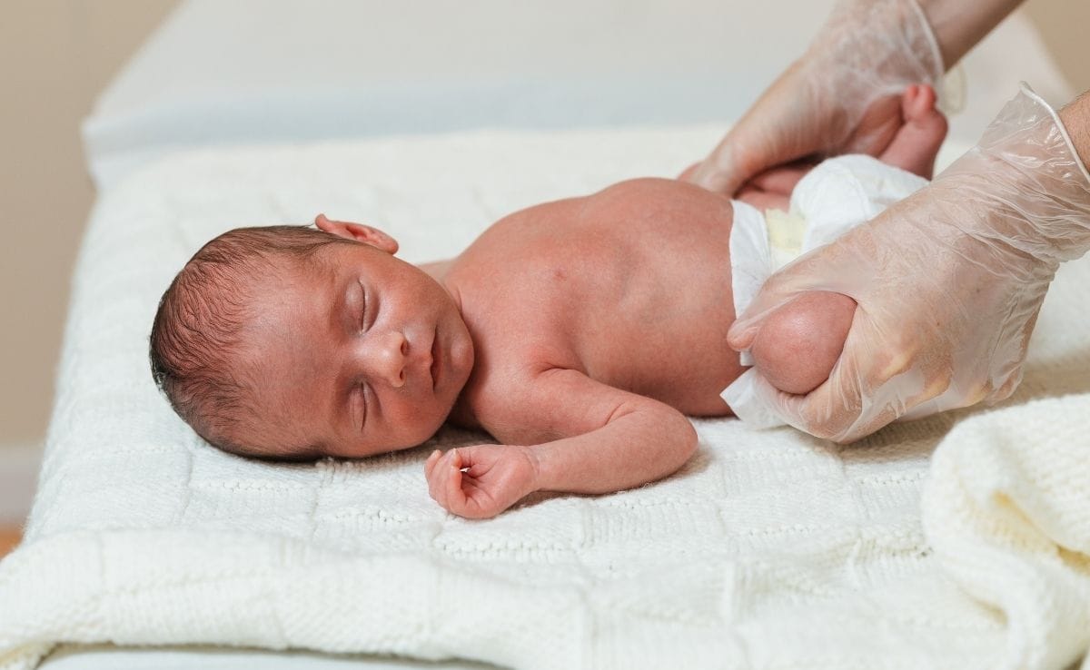 Baby Boy Circumcision