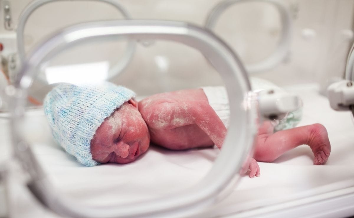When Circumcision Should Not Be Done : Premature Baby