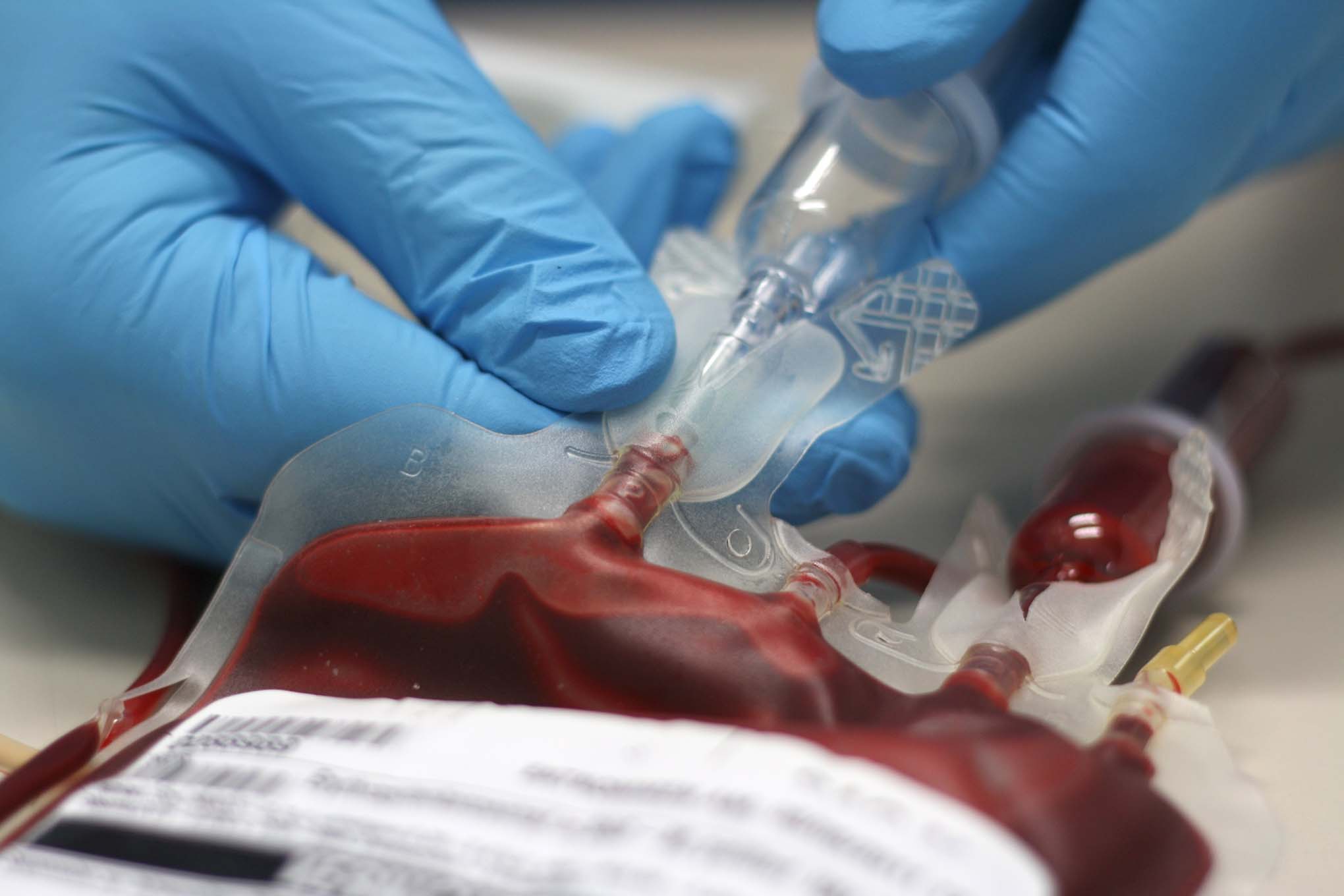 What Is HIV? Symptoms, Transmission & Testing in Malaysia 5 blood transfusion