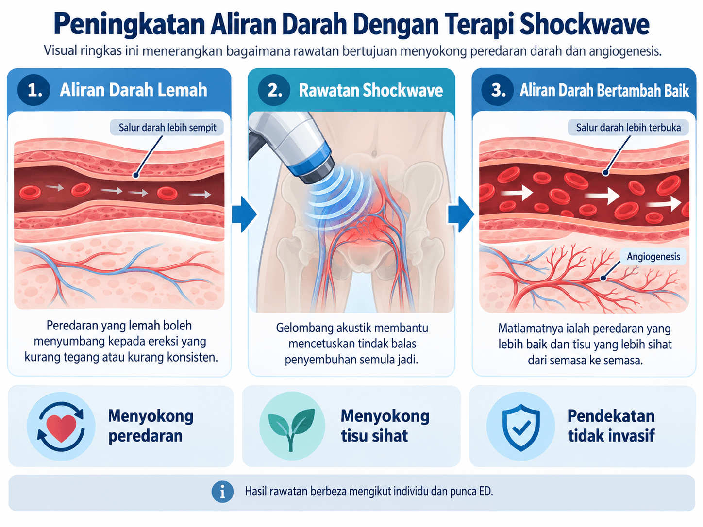 Adakah Terapi Shockwave Benar-benar Merawat ED? Panduan Malaysia 2 Terapi shockwave membantu meningkatkan aliran darah